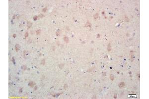 Formalin-fixed and paraffin embedded rat brain labeled with Rabbit Anti MCK10/CD167a/DDR1 Polyclonal Antibody, Unconjugated (ABIN671706) at 1:200 followed by conjugation to the secondary antibody and DAB staining (DDR1 antibody  (AA 21-120))