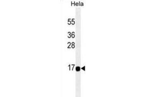 Western Blotting (WB) image for anti-Acyl-CoA Thioesterase 13 (ACOT13) antibody (ABIN2995329) (THEM2 antibody)