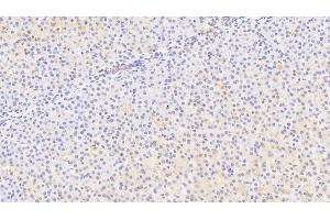 Detection of MFRN in Human Liver Tissue using Polyclonal Antibody to Mitoferrin (MFRN) (SLC25A37 antibody  (AA 65-338))