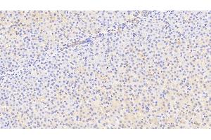 Detection of MFRN in Human Liver Tissue using Polyclonal Antibody to Mitoferrin (MFRN)