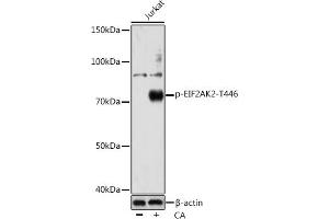 Western blot analysis of extracts of various cell lines, using Phospho-PKR/EIF2-T446 Rabbit mAb  at 1:1000 dilution. (EIF2AK2 antibody  (pThr446))