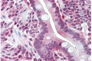 Human Small Intestine (formalin-fixed, paraffin-embedded) stained with BUB1 antibody ABIN293131 at 5 ug/ml followed by biotinylated goat anti-rabbit IgG secondary antibody ABIN481713, alkaline phosphatase-streptavidin and chromogen. (BUB1 antibody  (N-Term))