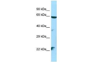 WB Suggested Anti-STK35 Antibody Titration: 1. (STK35 antibody  (N-Term))