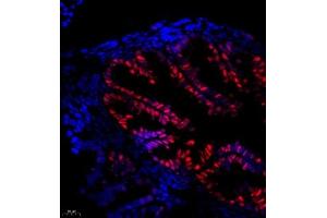 Immunofluorescence of paraffin embedded mouse fallopian tubes using Thymosin (ABIN7075306) at dilution of 1:1500 (400x lens) (PTMA antibody)