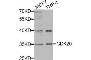 Western blot analysis of extracts of various cell lines, using CDK20 antibody. (CCRK antibody)