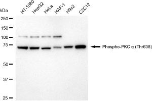 Western blotting analysis using phospho-PKC alpha (Thr638) antibody (ABIN7799988).