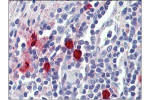 Tonsil, mast cells, Human: Formalin-Fixed, Paraffin-Embedded (FFPE) (CMA1 antibody)
