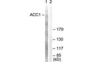 Western blot analysis of extracts from NIH-3T3 cells, treated with PMA 125ng/ml 30', using ACC1 (Ab-80) Antibody.