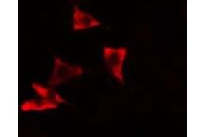 ABIN6278628 staining A549 cells by IF/ICC. (RHPN1 antibody  (C-Term))