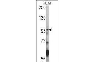 Western blot analysis of hHDAC7-A935 in CEM cell line lysates (35ug/lane) (HDAC7 antibody  (C-Term))