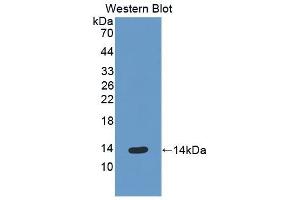 Detection of Recombinant ENA78, Human using Polyclonal Antibody to Epithelial Neutrophil Activating Peptide 78 (ENA78) (CXCL5 antibody  (AA 41-132))