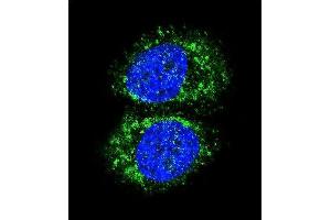 Confocal immunofluorescent analysis of RELA Antibody (N-term) (ABIN1882124 and ABIN2841044) with MCF-7 cell followed by Alexa Fluor 488-conjugated goat anti-rabbit lgG (green). (NF-kB p65 antibody  (N-Term))