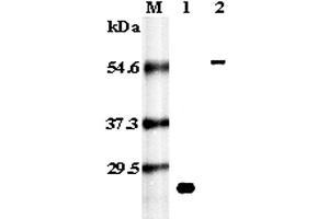 Western blot analysis using anti-RANK (human), pAb  at 1:5,000 dilution.