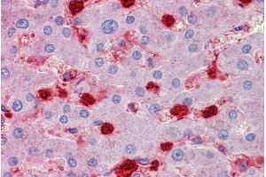 ABIN335161 (2. (S100A9 antibody  (Internal Region))