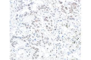 Immunohistochemistry (IHC) image for anti-Nucleoprotein TPR (TPR) (C-Term) antibody (ABIN7448922)