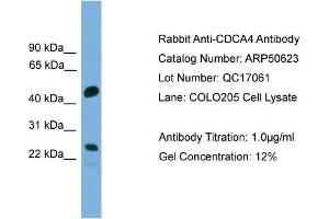 WB Suggested Anti-CDCA4  Antibody Titration: 0. (CDCA4 antibody  (Middle Region))