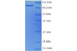 SDS-PAGE (SDS) image for SACC (AA 25-677) protein (His tag) (ABIN5711004)