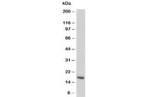 Western blot testing of Troponin C antibody and rat skeletal muscle tissue lysate (TNNC1 antibody  (N-Term))