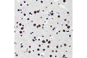 Immunohistochemistry of paraffin-embedded mouse brain using K/TRIM28 antibody (ABIN7270986) at dilution of 1:100 (40x lens). (KAP1 antibody)