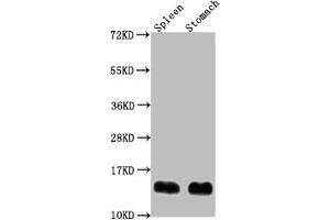 Western Blot Positive WB detected in: Mouse spleen tissue, Mouse stomach tissue All lanes: B2m antibody at 1:2000 Secondary Goat polyclonal to rabbit IgG at 1/50000 dilution Predicted band size: 14 kDa Observed band size: 14 kDa (beta-2 Microglobulin antibody  (AA 21-119))