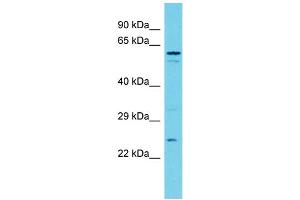 Host: Rabbit Target Name: TXNDC9 Sample Type: MDA-MB-435S Whole Cell lysates Antibody Dilution: 1. (TXNDC9 antibody  (N-Term))