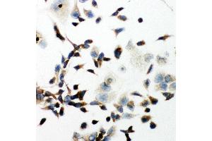 Anti-VEGF Receptor 2 antibody, ICC ICC: HELA Cell (VEGFR2/CD309 antibody  (Middle Region))