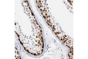 Immunohistochemical staining (Formalin-fixed paraffin-embedded sections) of human testis shows strong nuclear positivity in spermatogonia and spermatocytes. (RHOXF2 antibody)