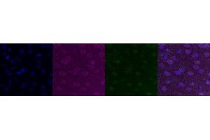 Immunohistochemistry (IHC) image for anti-Cholinergic Receptor, Nicotinic, alpha 6 (CHRNA6) antibody (ABIN7455986) (CHRNA6 antibody)