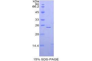 SDS-PAGE (SDS) image for Spectrin alpha Chain, Brain (SPTAN1) (AA 1605-1806) protein (His tag) (ABIN1877356) (SPTAN1 Protein (AA 1605-1806) (His tag))