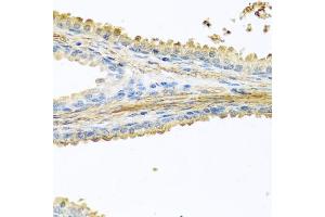 Immunohistochemistry of paraffin-embedded human prostate using PIP antibody (ABIN6131693, ABIN6145670, ABIN6145672 and ABIN6222022) at dilution of 1:100 (40x lens). (PIP antibody  (AA 29-146))