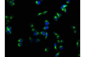 Immunofluorescence staining of Hela cells with ABIN7175125 at 1:133, counter-stained with DAPI. (PLAUR antibody  (AA 23-305))