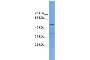 WB Suggested Anti-ARHGAP1 Antibody Titration: 0. (ARHGAP1 antibody  (N-Term))