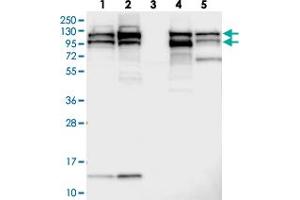 Western blot analysis of Lane 1: RT-4, Lane 2: U-251 MG, Lane 3: Human Plasma, Lane 4: Liver, Lane 5: Tonsil with SEC24C polyclonal antibody  at 1:250-1:500 dilution.