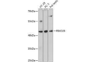 Western blot analysis of extracts of various cell lines, using FBXO28 antibody (ABIN7267088) at 1:1000 dilution. (FBXO28 antibody  (AA 91-312))