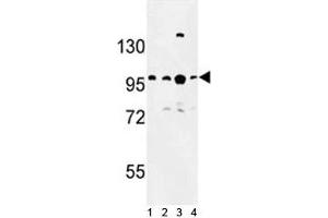Western blot analysis of BCL11A antibody and 1) Jurkat, 2) Ramos, 3) 293 and 4)NCI-H460 lysate.