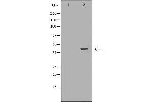 Western blot analysis of extracts of K562, using ABO antibody. (ABO antibody  (N-Term))