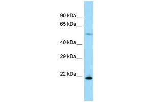 Host: Rabbit Target Name: Rpl17 Sample Type: Rat Pancreas lysates Antibody Dilution: 1. (RPL17 antibody  (C-Term))