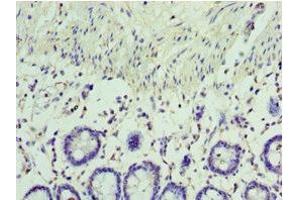 Immunohistochemistry of paraffin-embedded human colon tissue using ABIN7167058 at dilution of 1:100