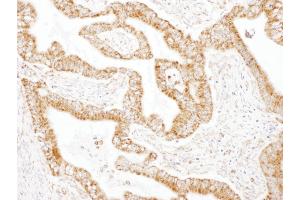 Immunohistochemistry (IHC) image for anti-Glutamic-Oxaloacetic Transaminase 2, Mitochondrial (Aspartate Aminotransferase 2) (GOT2) (AA 380-430) antibody (ABIN7454581)