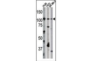 Image no. 1 for anti-Retinoblastoma 1 (RB1) (pSer612) antibody (ABIN358212) (Retinoblastoma 1 antibody  (pSer612))