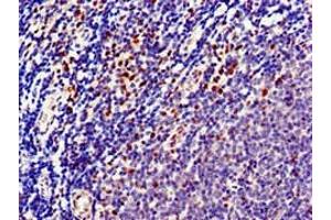 Immunohistochemistry of paraffin-embedded human lymph node tissue using ABIN7150733 at dilution of 1:100