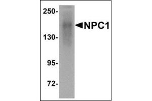 Western blot analysis of NPC1 in human kidney tissue lysate with this product at 1 μg/ml. (NPC1 antibody  (C-Term))