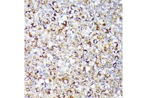 Immunohistochemistry (IHC) image for anti-Receptor (TNFRSF)-Interacting serine-threonine Kinase 1 (RIPK1) (AA 170-440) antibody (ABIN6146959)