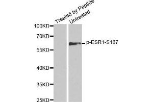 Western blot analysis of extracts from MCF7 cells using Phospho-ESR1-S167 antibody. (Estrogen Receptor alpha antibody  (pSer167))
