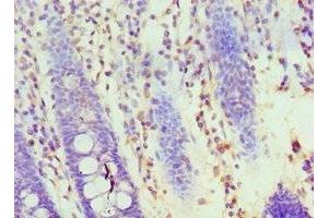 Immunohistochemistry of paraffin-embedded human colon tissue using ABIN7155707 at dilution of 1:100