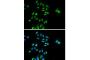 Immunofluorescence analysis of U2OS cell using PHC3 antibody.