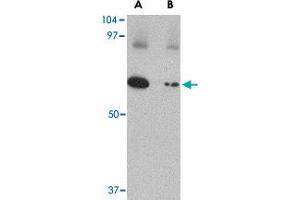 Western blot analysis of SLC22A17 in SK-N-SH lysate with SLC22A17 polyclonal antibody  at 1 ug/mL in (A) the absence and (B) the presence of blocking peptide. (SLC22A17 antibody  (C-Term))