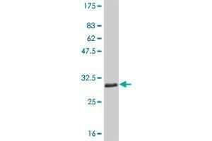 Western Blot detection against Immunogen (30. (SLC11A1 antibody  (AA 308-350))