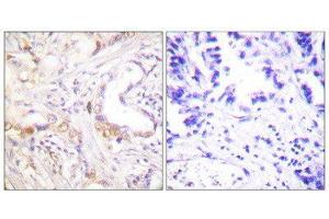 Immunohistochemistry (IHC) image for anti-Protein Inhibitor of Activated STAT, 3 (PIAS3) (N-Term) antibody (ABIN1848836)