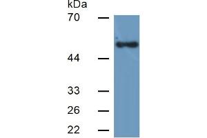 Western Blotting (WB) image for Lipase, Hepatic (LIPC) ELISA Kit (ABIN6574200)